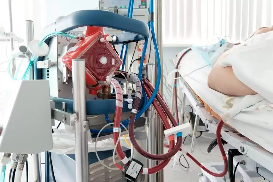 Máquina de oxigenação por membrana extracorpórea (Ecmo)